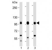 Western blot testing of human 1) Daudi, 2) Raji and 3) Jurkat cell lysate with MAP4K1 antibody at 1:2000. Predicted molecular weight ~91 kDa.