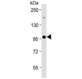 Western blot testing of human Raji cell lysate with MAP4K1 antibody at 1:2000. Predicted molecular weight ~91 kDa.~