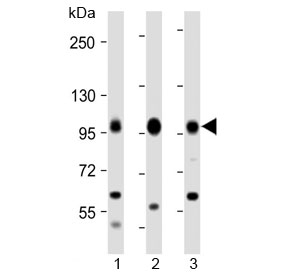 Western blot testing of human 1) Daudi, 2) Raji and 3) Jurkat cell lysate with MAP4K1 antibody at 1:2000. Predicted mol