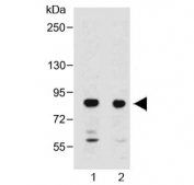 Western blot testing of 1) human liver and 2) mouse liver lysate with MUT antibody at 1:2000. Predicted molecular weight ~83 kDa.