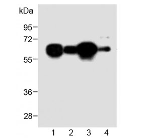 Western blot testing of human 1) HL60, 2) A431, 3) Jurkat and 4) mouse NIH3T3 cell lysate with METTL14 antibody at 1:2000. Predicted molecular weight ~52 kDa.