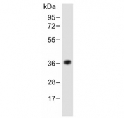 Western blot testing of human skeletal muscle lysate with TAS2R5 antibody at 1:1000. Predicted molecular weight ~35 kDa.
