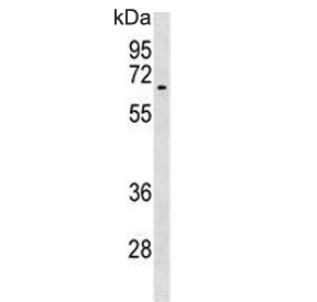 Western blot testing of human T-47D cell lysate with ACVR1 antibody at 1:1000. Predicted molecular weight ~57 kDa.