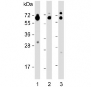 Western blot testing of human 1) kidney, 2) lung and 3) testis lysate with HHLA2 antibody. Expected molecular weight: 38-60 kDa depending on glycosylation level.