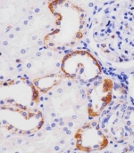 IHC staining of FFPE human kidney with HHLA2 antibody. HIER: boil tissue sections in pH6, 10mM citrate buffer, for 20 min and allow to cool before testing.