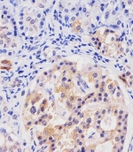 IHC staining of FFPE human pancreas with HHLA2 antibody. HIER: boil tissue sections in pH6, 10mM citrate buffer, for 20 min and allow to cool before testing.