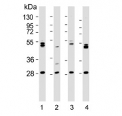 Western blot testing of human 1) 293T, 2) kidney, 3) HL60 and 4) K562 lysate with ARV1 antibody. Predicted molecular weight ~31 kDa.