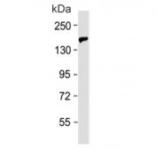 Western blot testing of rat skeletal muscle lysate with BCORL1 antibody. Predicted molecular weight ~182 kDa.