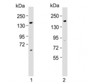 Western blot testing of human 1) HL60 and 2) Caco-2 lysate with BCORL1 antibody. Predicted molecular weight ~182 kDa.