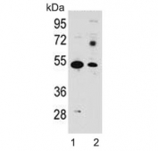 Western blot testing of mouse 1) brain and 2) stomach lysate with SLC16A11 antibody. Predicted molecular weight ~48 kDa.