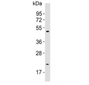 Western blot testing of human A549 lysate with SLC16A11 antibody. Predicted molecular weight ~48 kDa.