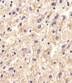 IHC testing of FFPE human liver tissue with SLC16A11 antibody. HIER: steam section in pH6 citrate buffer for 20 min and allow to cool prior to staining.