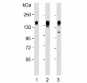 Western blot testing of human 1) HepG2, 2) MDA-MB-231 and 3) SW480 cell lysate with CD130 antibody. Expected molecular weight: 104-140 kDa depending on glycosylation level.