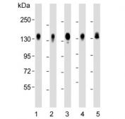 Western blot testing of human 1) HeLa, 2) MDA-MB-231, 3) HepG2, 4) SW480 and 5) A549 cell lysate with CD130 antibody. Expected molecular weight: 104-140 kDa depending on glycosylation level.