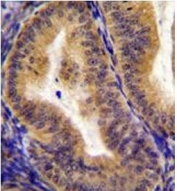 IHC testing of FFPE human uterus tissue with CD130 antibody. HIER: steam section in pH6 citrate buffer for 20 min and allow to cool prior to staining.