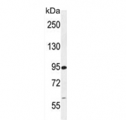 Western blot testing of human Jurkat lysate with RSBN1 antibody. Predicted molecular weight ~91 kDa.