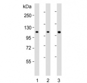 Western blot testing of human 1) liver, 2) MCF7 and 3) HL60 lysate with RSBN1 antibody. Predicted molecular weight ~91 kDa.