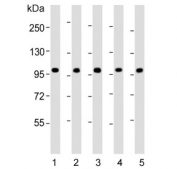 Western blot testing of human 1) CCRF-CEM, 2) Jurkat, 3) liver, 4) MCF7 and 5) HL60 lysate with RSBN1 antibody. Predicted molecular weight ~91 kDa.