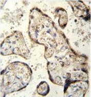 IHC testing of FFPE human placenta tissue with RSBN1 antibody. HIER: steam section in pH6 citrate buffer for 20 min and allow to cool prior to staining.