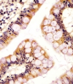 IHC testing of FFPE human colon tissue with RSBN1 antibody. HIER: steam section in pH6 citrate buffer for 20 min and allow to cool prior to staining.