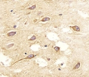 IHC testing of FFPE human brain tissue with NOS2 antibody. HIER: steam section in pH6 citrate buffer for 20 min and allow to cool prior to staining.