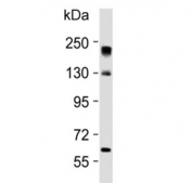 Western blot testing of human Y79 cell lysate with NOS2 antibody. Predicted molecular weight ~130 kDa.