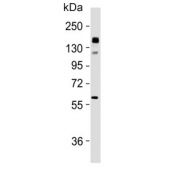 Western blot testing of human A549 cell lysate with NOS2 antibody. Predicted molecular weight ~130 kDa.