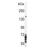Western blot testing of human CEM cell lysate with NOS2 antibody. Predicted molecular weight ~130 kDa.