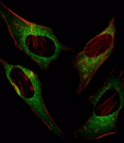 Immunofluorescent staining of fixed and permeabilized human HeLa cells with GADD153 antibody (green) and anti-Actin (red).