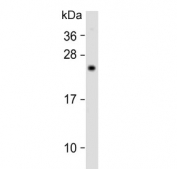 Western blot testing of human skeletal muscle lysate with GADD153 antibody. Expected molecular weight: 19-29 kDa.