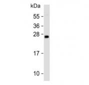 Western blot testing of human PC-3 cell lysate with GADD153 antibody. Expected molecular weight: 19-29 kDa.
