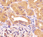 IHC testing of FFPE human kidney tissue with PCCA antibody. HIER: steam section in pH6 citrate buffer for 20 min and allow to cool prior to staining.