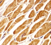 IHC testing of FFPE human heart tissue with PCCA antibody. HIER: steam section in pH6 citrate buffer for 20 min and allow to cool prior to staining.