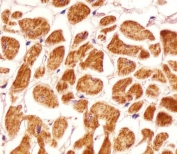 IHC testing of FFPE human heart tissue with PCCA antibody. HIER: steam section in pH6 citrate buffer for 20 min and allow to cool prior to staining.