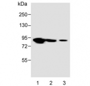 Western blot testing of human 1) U-87 MG, 2) MCF7 and 3) K562 cell lysate with LH1 antibody. Predicted molecular weight ~83 kDa.