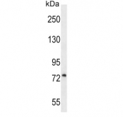 Western blot testing of human U251 cell lysate with LH1 antibody. Predicted molecular weight ~83 kDa.