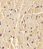 IHC testing of FFPE human heart tissue with LH1 antibody. HIER: steam section in pH6 citrate buffer for 20 min and allow to cool prior to staining.