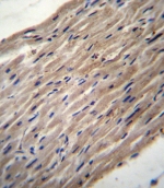 IHC testing of FFPE human heart tissue with LH1 antibody. HIER: steam section in pH6 citrate buffer for 20 min and allow to cool prior to staining.