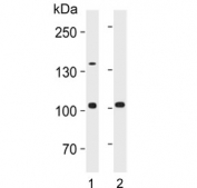 Western blot testing of human 1) Jukat and 2) uterus lysate with TERT antibody. Predicted molecular weight: 120-126 kDa (two isoforms may be visualized).