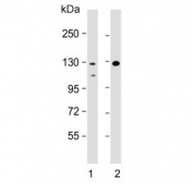 Western blot testing of human 1) Raji and 2) HL60 cell lysate with TERT antibody. Predicted molecular weight: 120-126 kDa (two isoforms may be visualized).