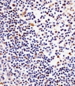 IHC testing of FFPE human tonsil tissue with TERT antibody. HIER: steam section in pH6 citrate buffer for 20 min and allow to cool prior to staining.
