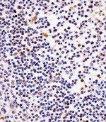 IHC testing of FFPE human tonsil tissue with TERT antibody. HIER: steam section in pH6 citrate buffer for 20 min and allow to cool prior to staining.