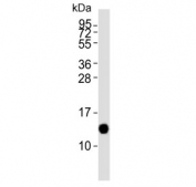 Western blot testing of human breast tissue lysate with Alpha Lactalbumin antibody. Predicted molecular weight ~16 kDa.