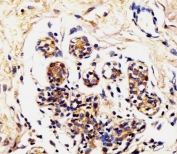 IHC testing of FFPE human breast tissue with Alpha Lactalbumin antibody. HIER: steam section in pH6 citrate buffer for 20 min and allow to cool prior to staining.