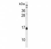 Western blot testing of human CEM cell lysate with Alpha Lactalbumin antibody. Predicted molecular weight ~16 kDa.