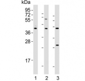 Western blot testing of human 1) brain, 2) K562 and 3) cerebellum lysate with DRD2 antibody. Predicted molecular weight ~51 kDa.