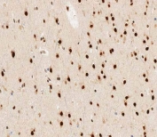 IHC testing of FFPE human brain tissue with hnRNP R antibody. HIER: steam section in pH6 citrate buffer for 20 min and allow to cool prior to staining.