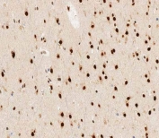 IHC testing of FFPE human brain tissue with hnRNP R antibody. HIER: steam section in pH6 citrate buffer for 20 min and allow to cool prior to staining.