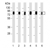 Western blot testing of human 1) 293T, 2) A431, 3) A549, 4) HepG2, 5) MOLT4 and 6) U-251 MG cell lysate with hnRNP R antibody. Predicted molecular weight: 67, 71 kDa. 