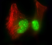 Immunofluorescent staining of fixed and permeabilized human HeLa cells with hnRNP R antibody (green) and anti-Actin (red).